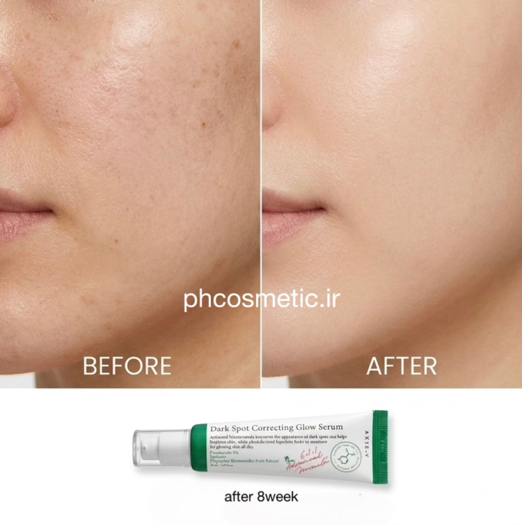 ضدلک اکسیس وای سرم AXIS-Y Dark Spot Correcting Glow Serum